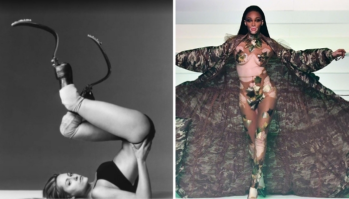 10+ Models Who Are Redefining Beauty And Shattering Fashion Stereotypes