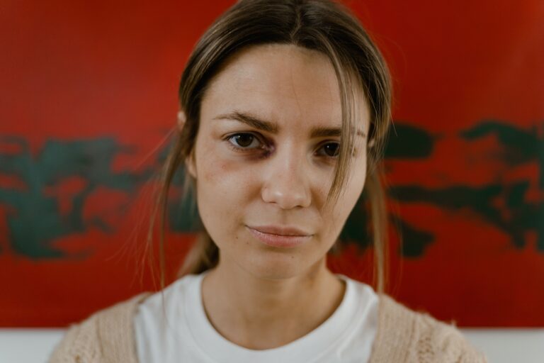 ‘Someone tried to lure me out of my apartment with the recording of an injured woman.’